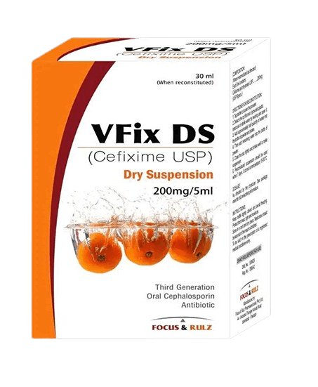 vfix